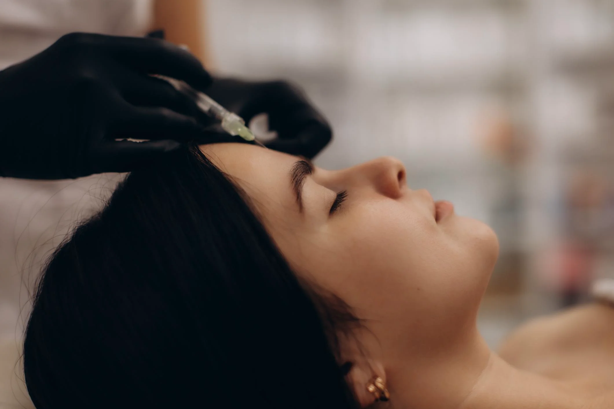 Botox treatment results in Knoxville TN - natural, refreshed look